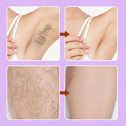 Dermellea Bikini Hair Removal Cream & Mousse Set – Pain-Free, Gentle & Fast for Sensitive Skin