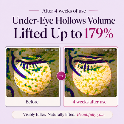 🔥Last Day Buy 1 Get 1 Free Dermellea Calcium Brightening Eye Cream