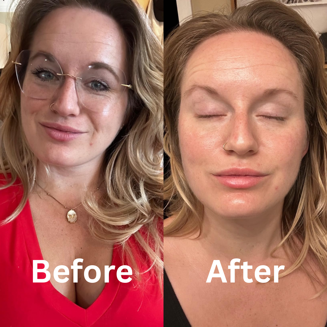 Mirevyn Collagen Glow Up Hydrogel Mask